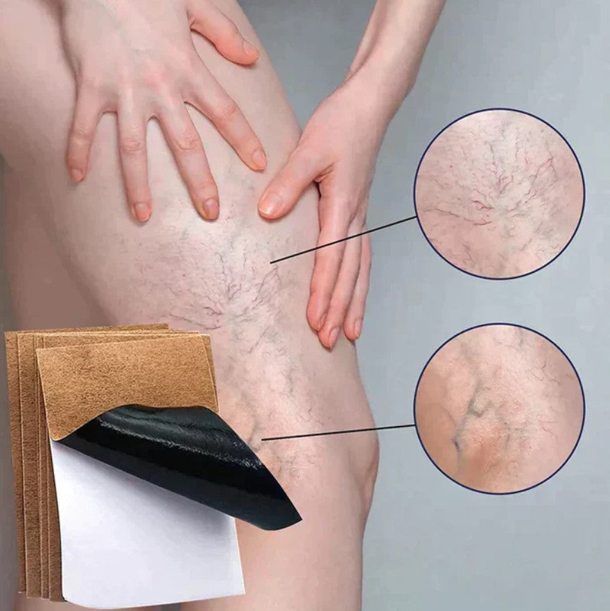 PARCHES PARA VARICES X3 CAJAS
