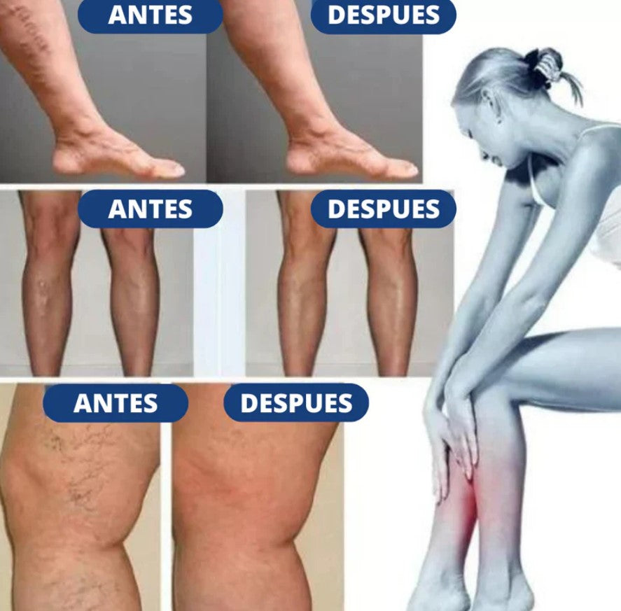 PARCHES PARA VARICES X3 CAJAS